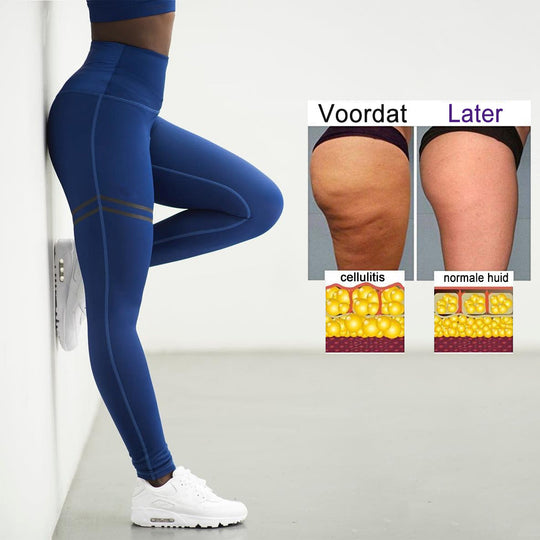 Cellulite Kompressionsleggings für Frauen